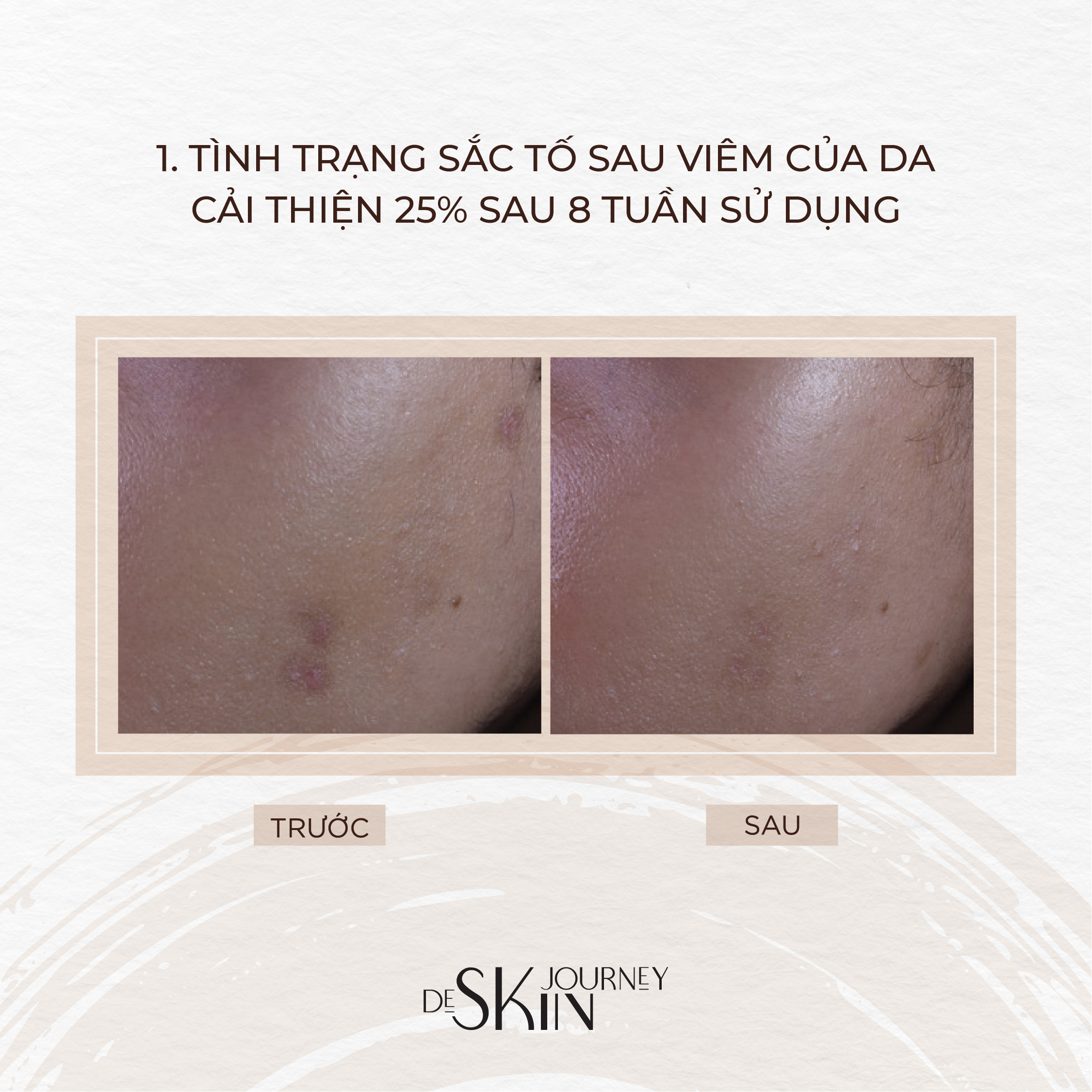 De Skin Journey: Brand Renewal & Freelance Projects
