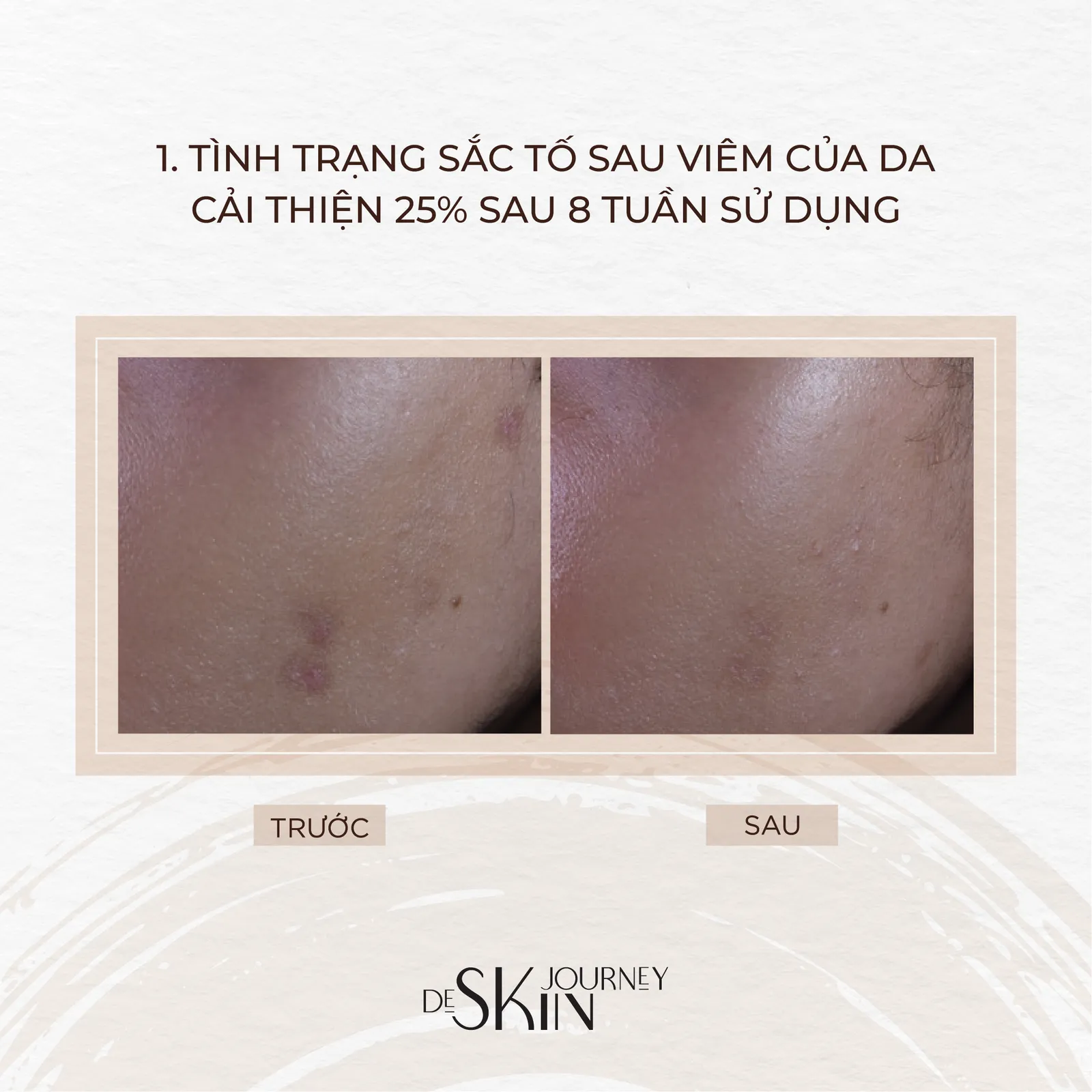 De Skin Journey: Brand Renewal & Freelance Projects